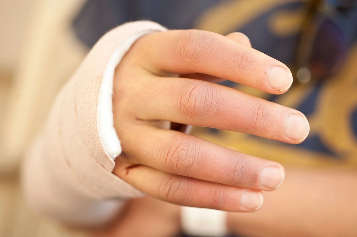 Wrist Arthritis