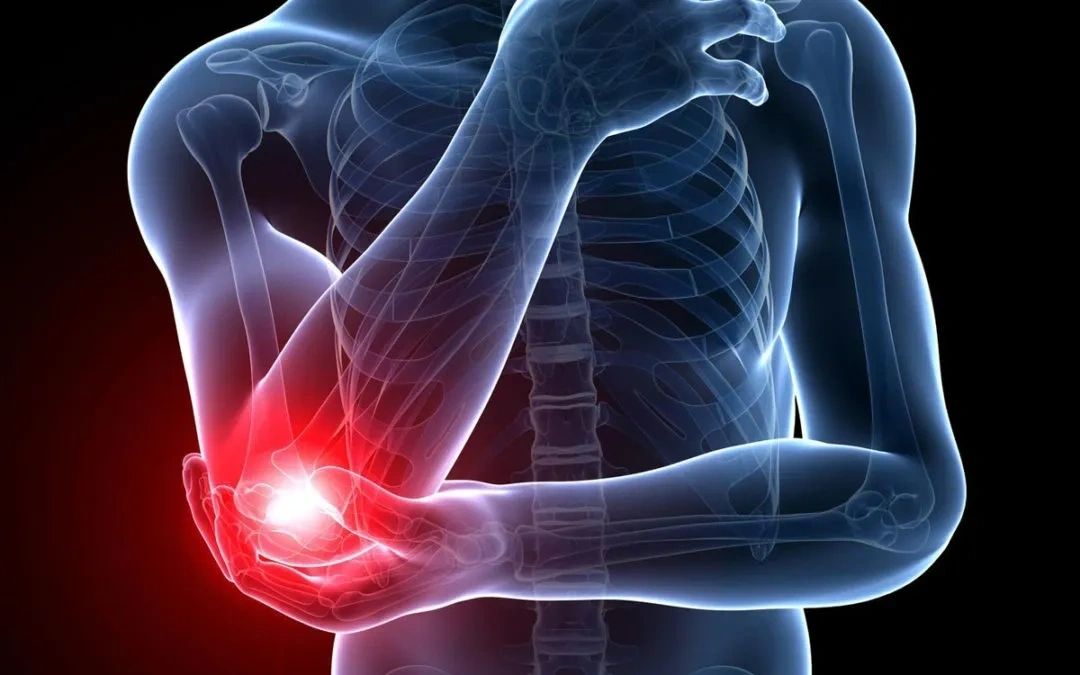 Tennis Elbow